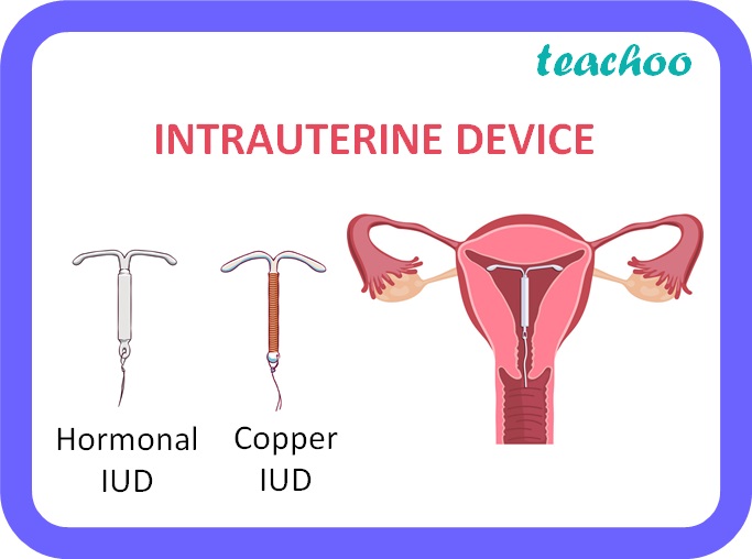 biology-if-a-woman-is-using-a-copper-t-will-it-help-in-protecting